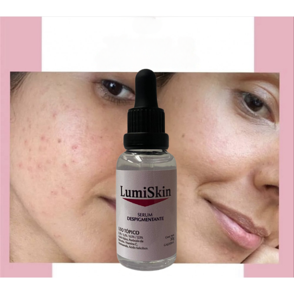 Serum Despigmentante Lumiskin